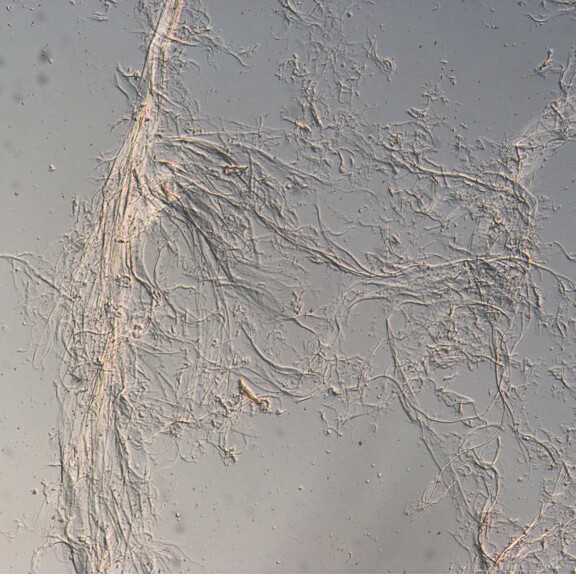 MFC valve for cellulose slurry MFC